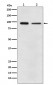 Anti-EEF2 Monoclonal Antibody